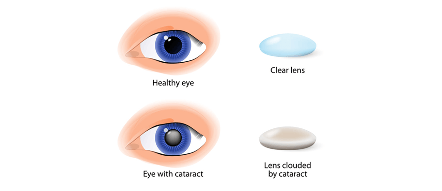 bifocal eyeglasses