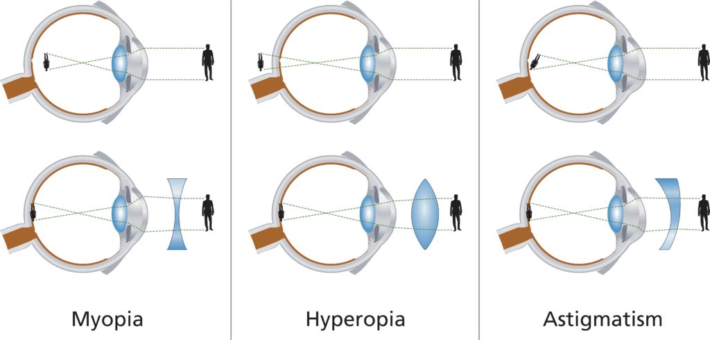 bifocal eyeglasses