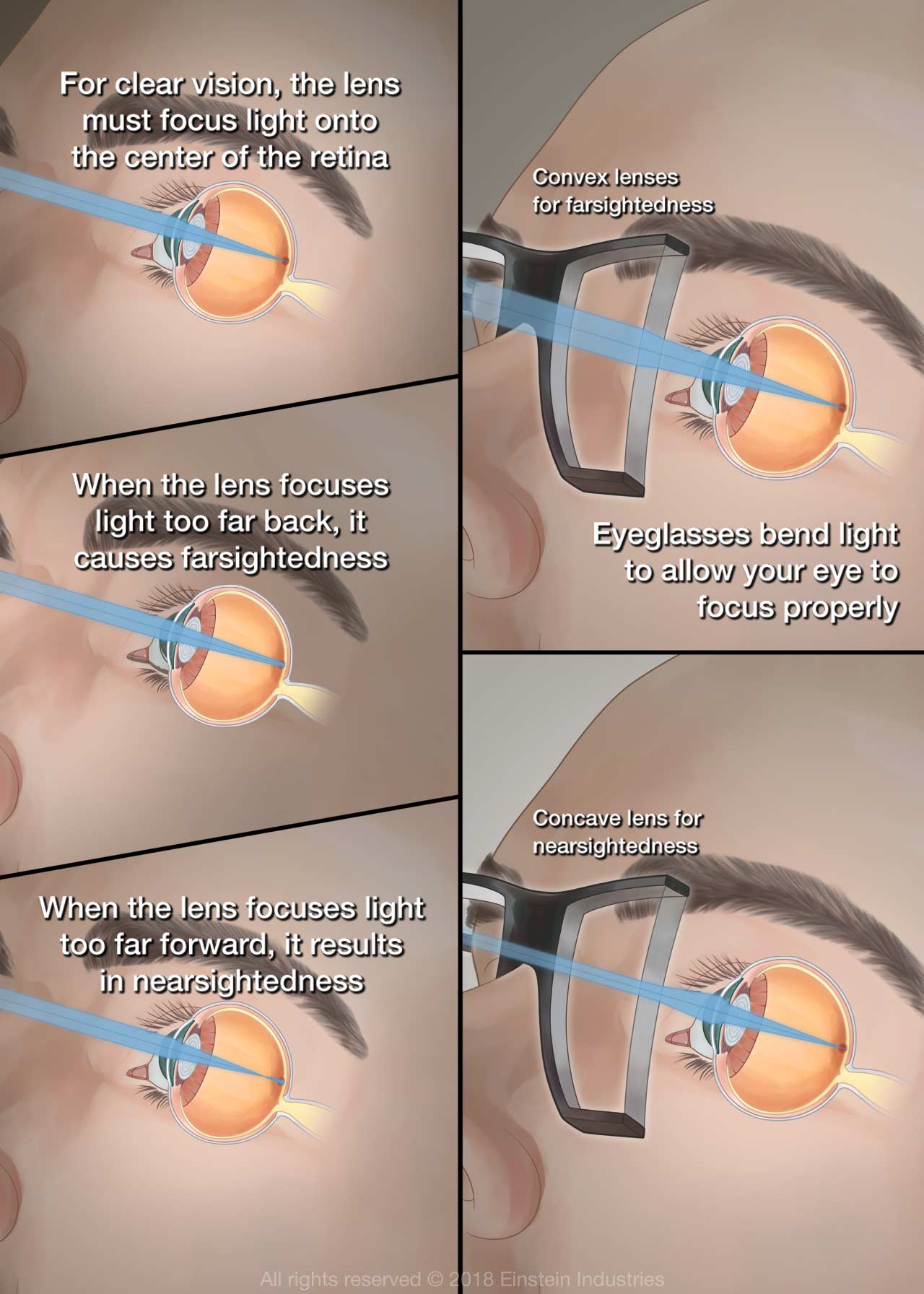 same-day glasses